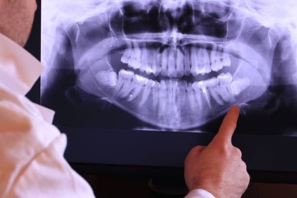 Best Emergency Dental Care for Broken or Chipped Teeth in Albany, LA