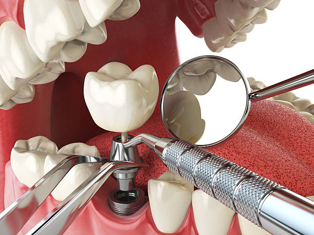 Emergency Dental Care for Adults